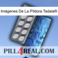 Imágenes De La Píldora Tadalafil 34